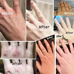 Anti-Wrinkle Hand Cream – Repairing, Moisturizing & Brightening for Dry Hands-2