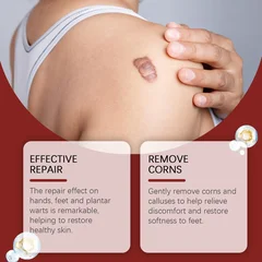 Bee Mole Acne Patch Collagen Daily Skin Care Repair Patch-4