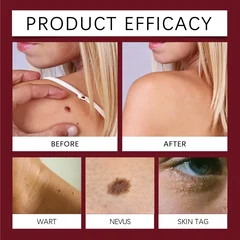 Bee Mole Acne Patch Collagen Daily Skin Care Repair Patch-5