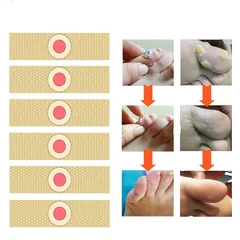 6/12/36-Pack Corn and Callus Removal Foot Pads-2