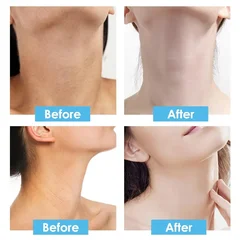 Neck Care Masks, 1/5/10 Pack-8
