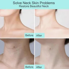 Neck Care Masks, 1/5/10 Pack-5