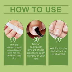 Onychomycosis Treatment Liquid Strong Formula Thickened Discolored Damaged Nail Care 30ml-5