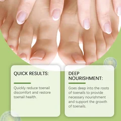 Onychomycosis Treatment Liquid Strong Formula Thickened Discolored Damaged Nail Care 30ml-2